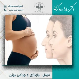 بارداری و جراحی بینی - دکتر سارارودگری